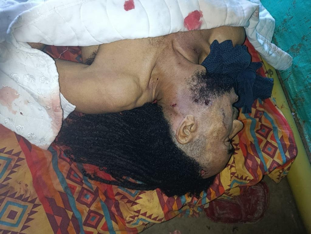 Indignación en Zona Bananera: dos cuerpos siguen sin levantamiento en la vereda Iberia mientras las familias esperan