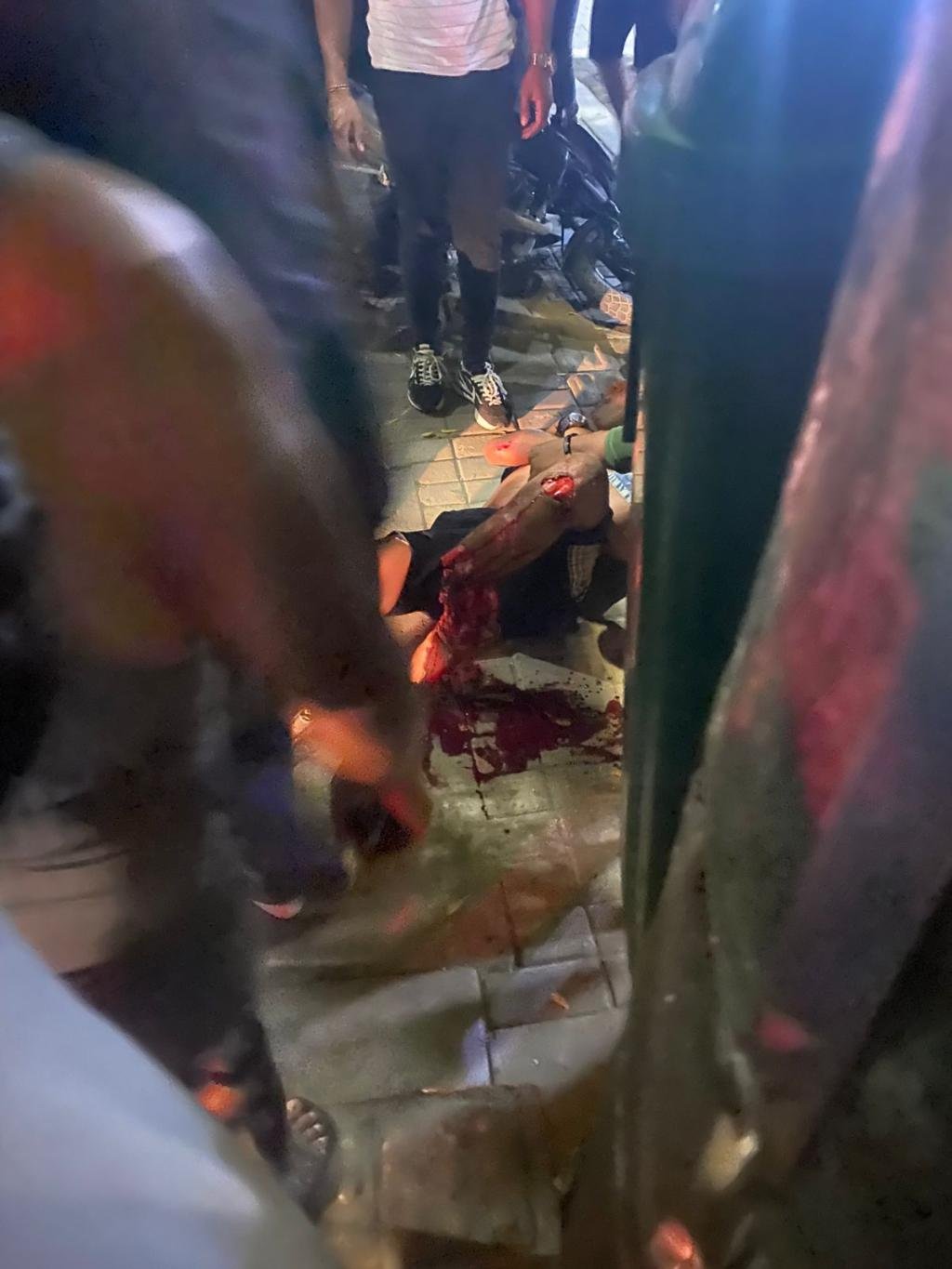 Se le destrozó la pierna tras grave accidente se tránsito cerca a la Olímpica de la 30