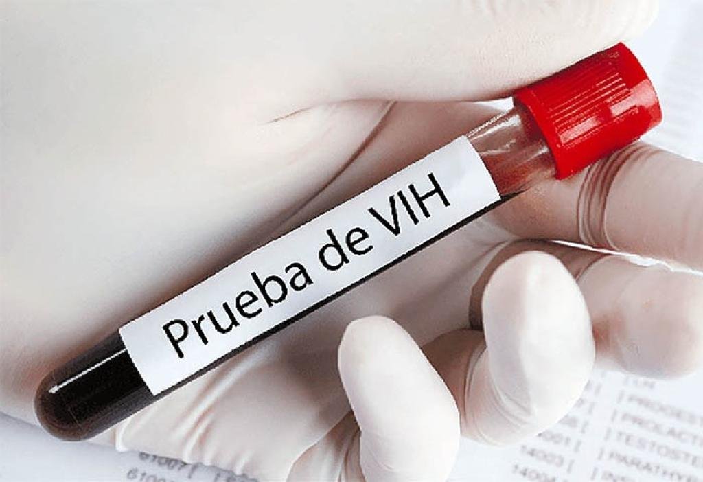 VIH en el Magdalena: cifras y estrategias de prevención