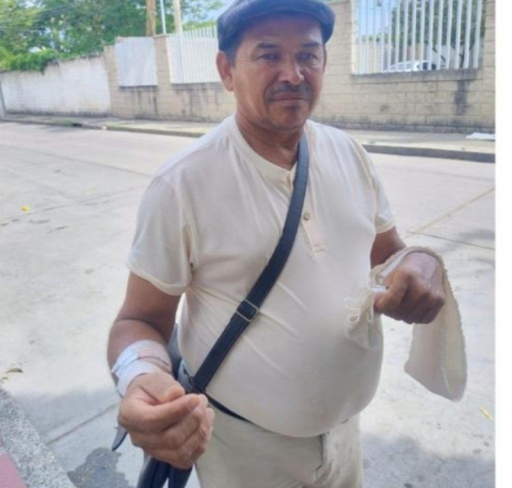 ¿Y ahora quién le hará los bollos? hombre no podrá trabajar por un buen tiempo tras ser atacado por un perro Pitbull