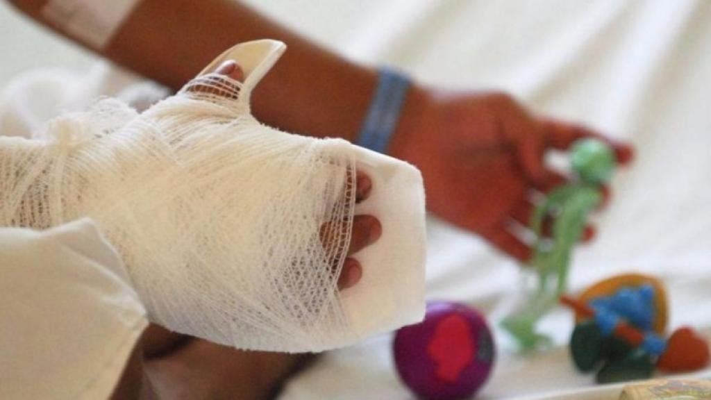 Día de las Velitas en Santa Marta y Magdalena   dejó 10 quemados: alarma por falta de control en los barrios