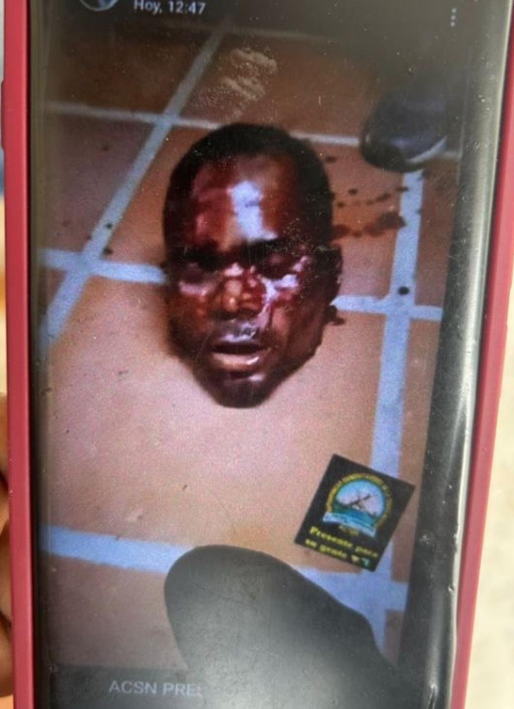 Zona Bananera vuelve a estremecerse: hallan decapitado a un hombre en Julio Zawady
